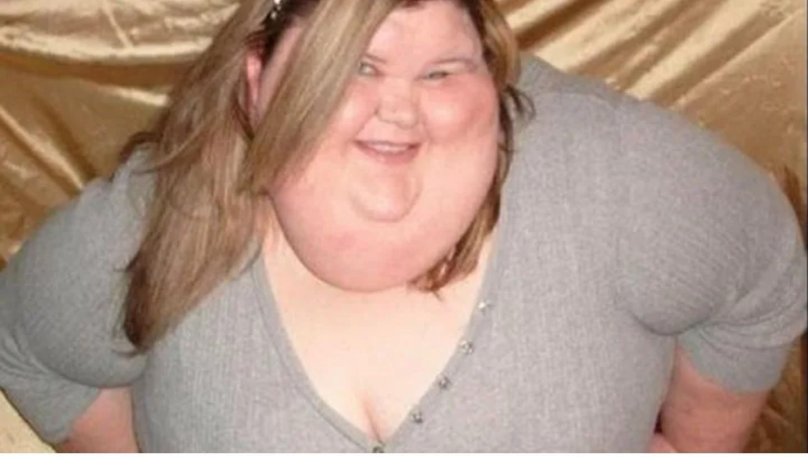 Толстое лицо девушки