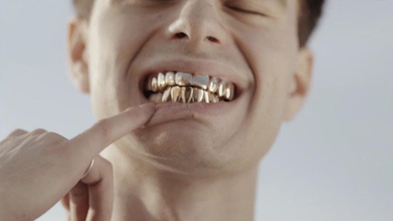 Рокет рэпер золотые зубы