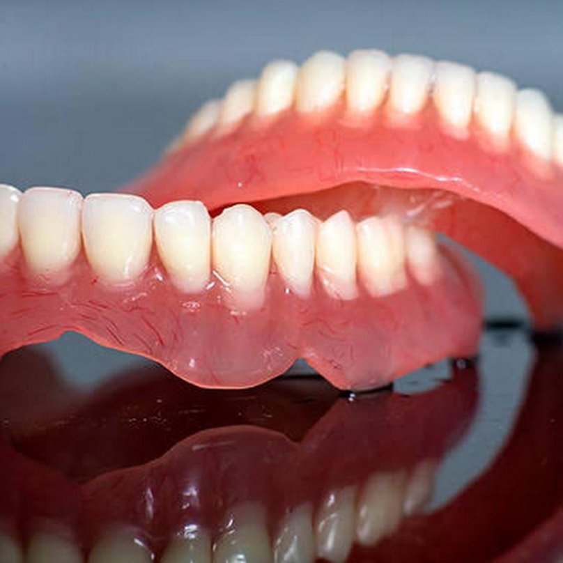 Нейлоновый микропротез 1-3 зуба