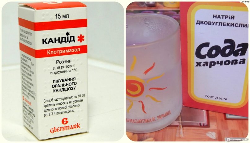 Таблетки от кандидоза полости рта