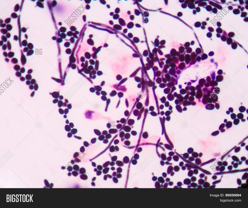 Псевдомицелий кандида