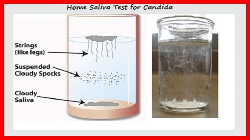 Домашний тест на кандиду со стаканом